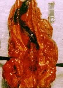 ��������ʬ�����ʬ�Ĳ�ͬ�������������̳�