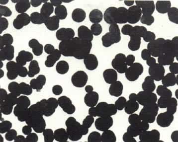 ���ѷ�̿�ڣ�1�򱶵羵Ƭ