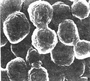 ͼ2���������ζ���岡���İ�����