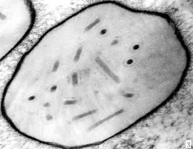 ͼ3���������Ͷ���岡���İ��������棨���������ͣ�