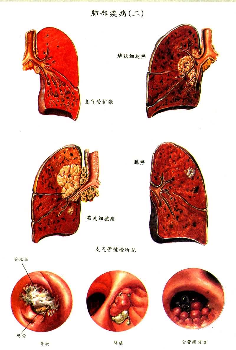 �β�����������