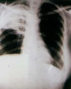 ��Ҷ����