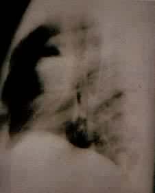 ��ŧ�ף���λ��