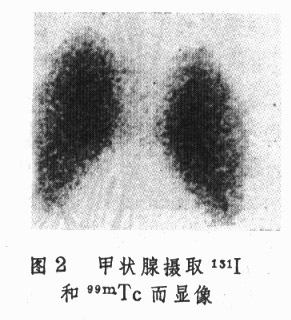 ͼ2